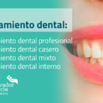 como es un blanqueamiento dental