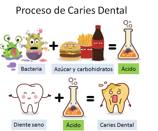 como se origina la caries dental