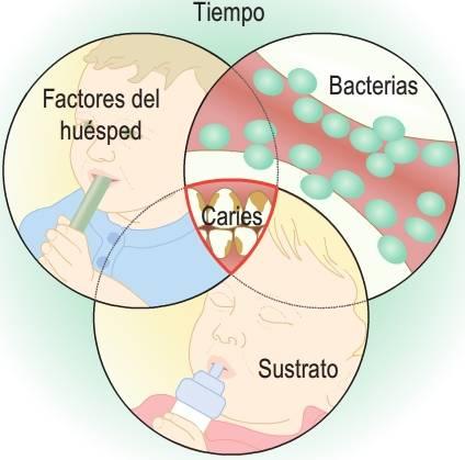 acción que podría provocar la caries