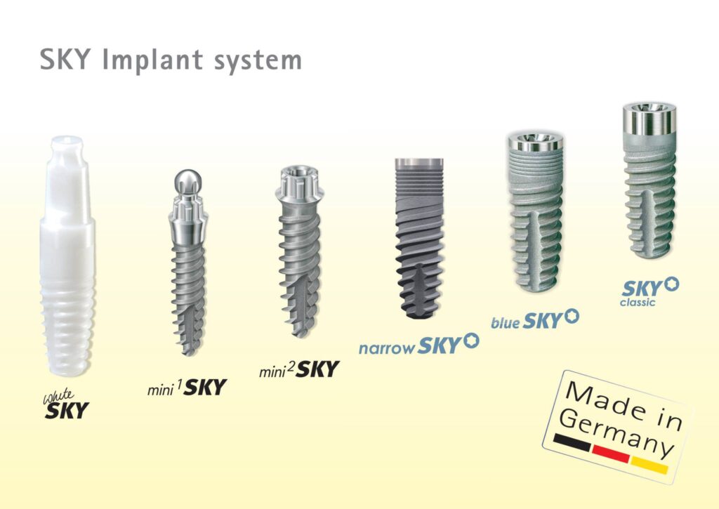 tipos de implantes dentales