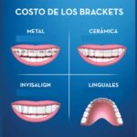 cuanto cuesta un tratamiento de ortodoncia