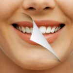 ventajas y desventajas del blanqueamiento dental